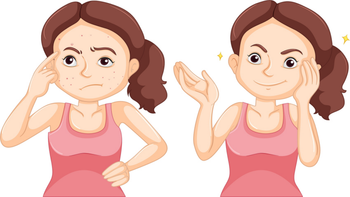 透明質酸與黑色素的關系