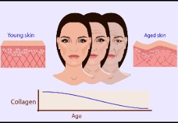 膠原蛋白只認A型